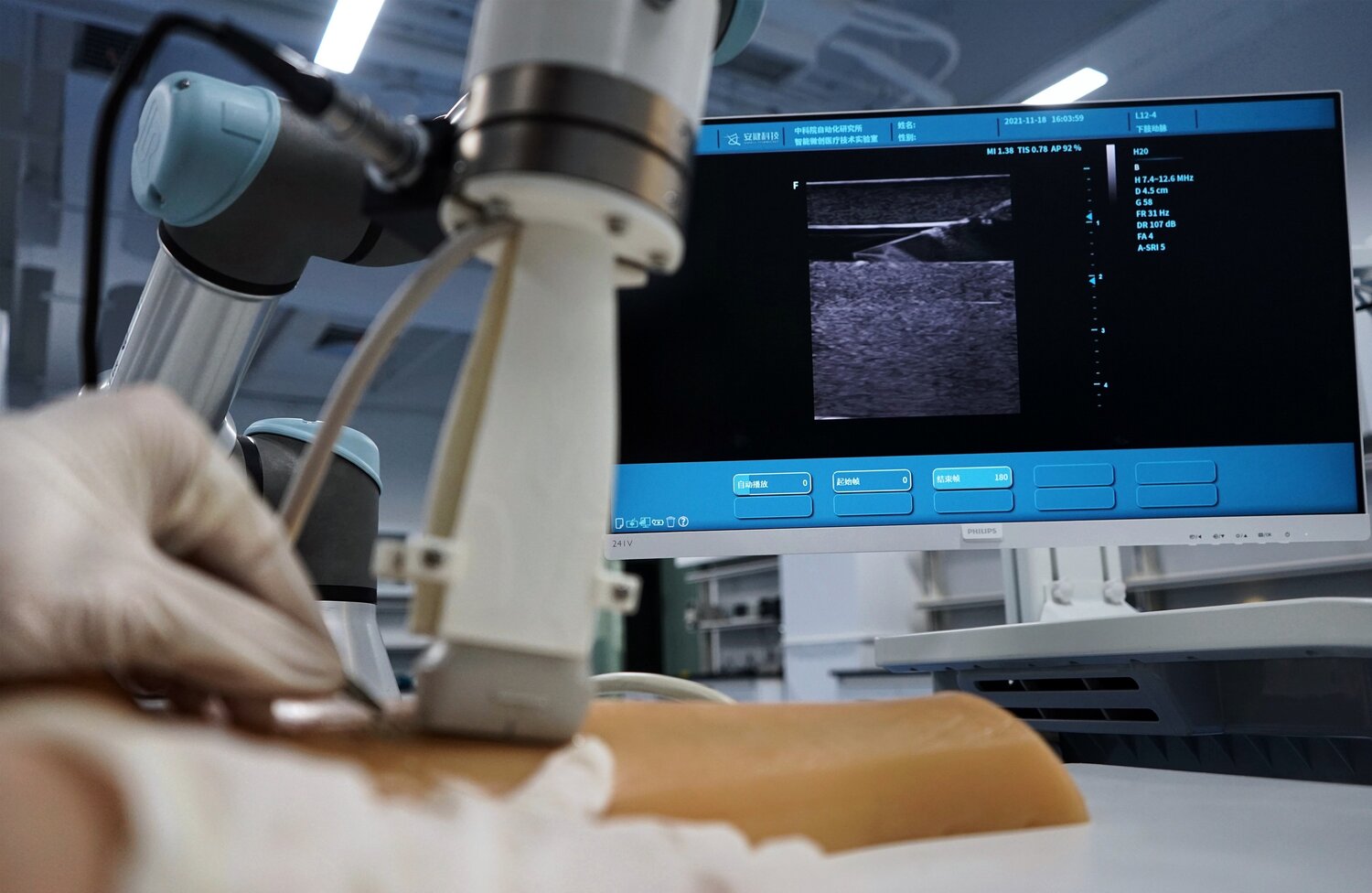 Assistive ultrasound robot
